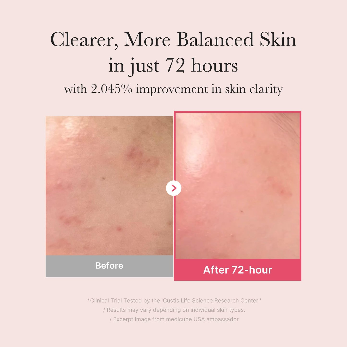 medicube TXA Glow & Care Duo: TXA+Niacinamide 15% Glow Facial Serum and TXA+Niacinamide Capsule Cream