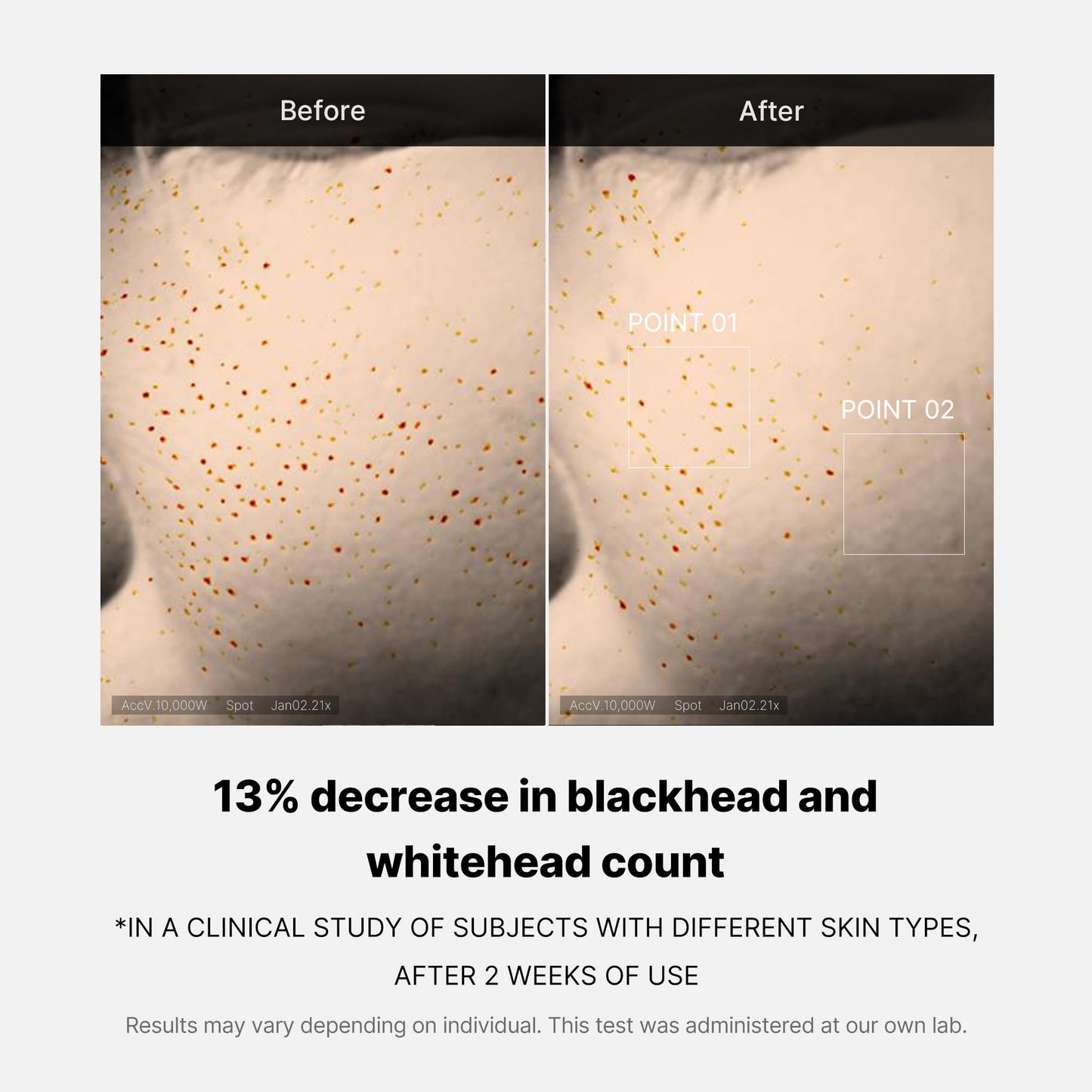 Medicube Zero Pore One-day Serum 1.01 fl.oz - Overnight Resurfacing Serum with Pore Tightening Complex - 15.2% AHA+BHA+PHA & 2% Niacinamide - 10.8% reduction in pore appearance after one day of use