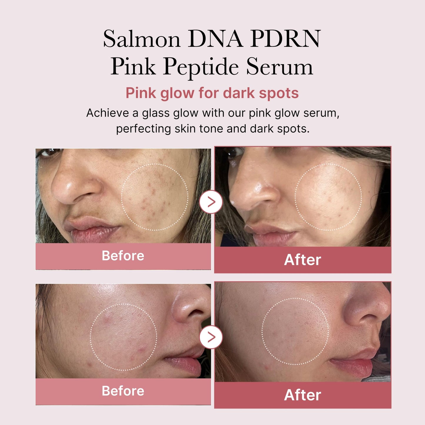 medicube Salmon DNA PDRN Duo for Beginner - Salmon DNA PDRN pink collagen jelly gel mask (4ea) + Salmon DNA PDRN Pink Peptide Serum, Pink glow serum