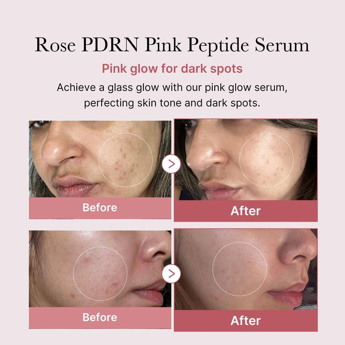 medicube Affordable Pink Routine Duo: Age-R Booster Pro Pink | 6-in-1 Real Glass Glow Beauty Massager and PDRN Peptide Serum