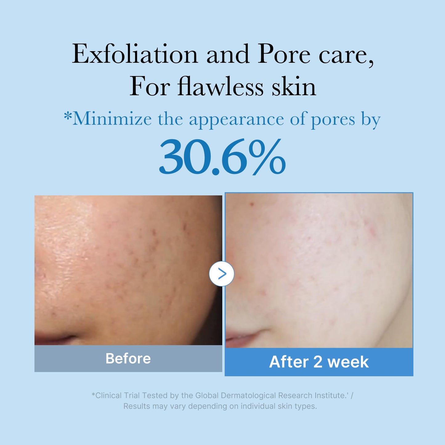 medicube Glass Glow Flawless Pore Care Step 1: Zero Pore Blackhead Deep Cleansing Oil and Zero Pore Toner