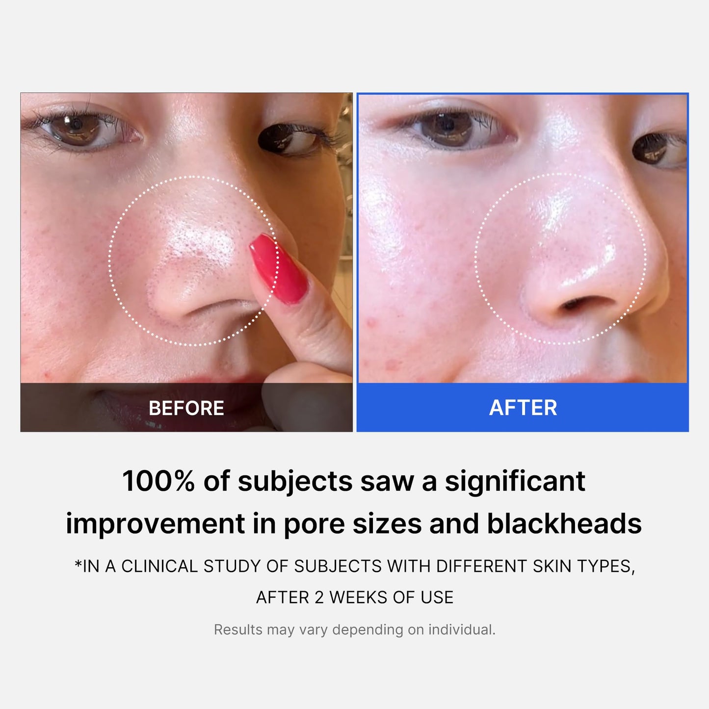 medicube daily toner pads tailored to skin condition: Zero Pore Pads 2.0 (2ea) and Zero Pore Pads Mild 2.0 (1ea)