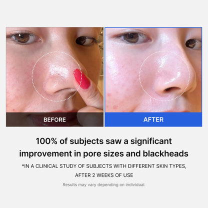 medicube daily toner pads tailored to skin condition: Zero Pore Pads 2.0 (2ea) and Zero Pore Pads Mild 2.0 (1ea)