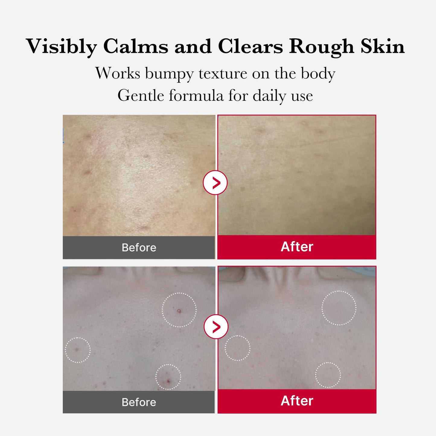 medicube Ultimate Red Spray Duo to Smooth & Soothe: Power Soothing Spray and Red Body Peeling Shot