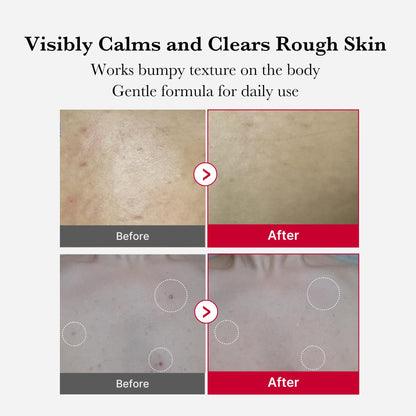 medicube Ultimate Red Spray Duo to Smooth & Soothe: Power Soothing Spray and Red Body Peeling Shot