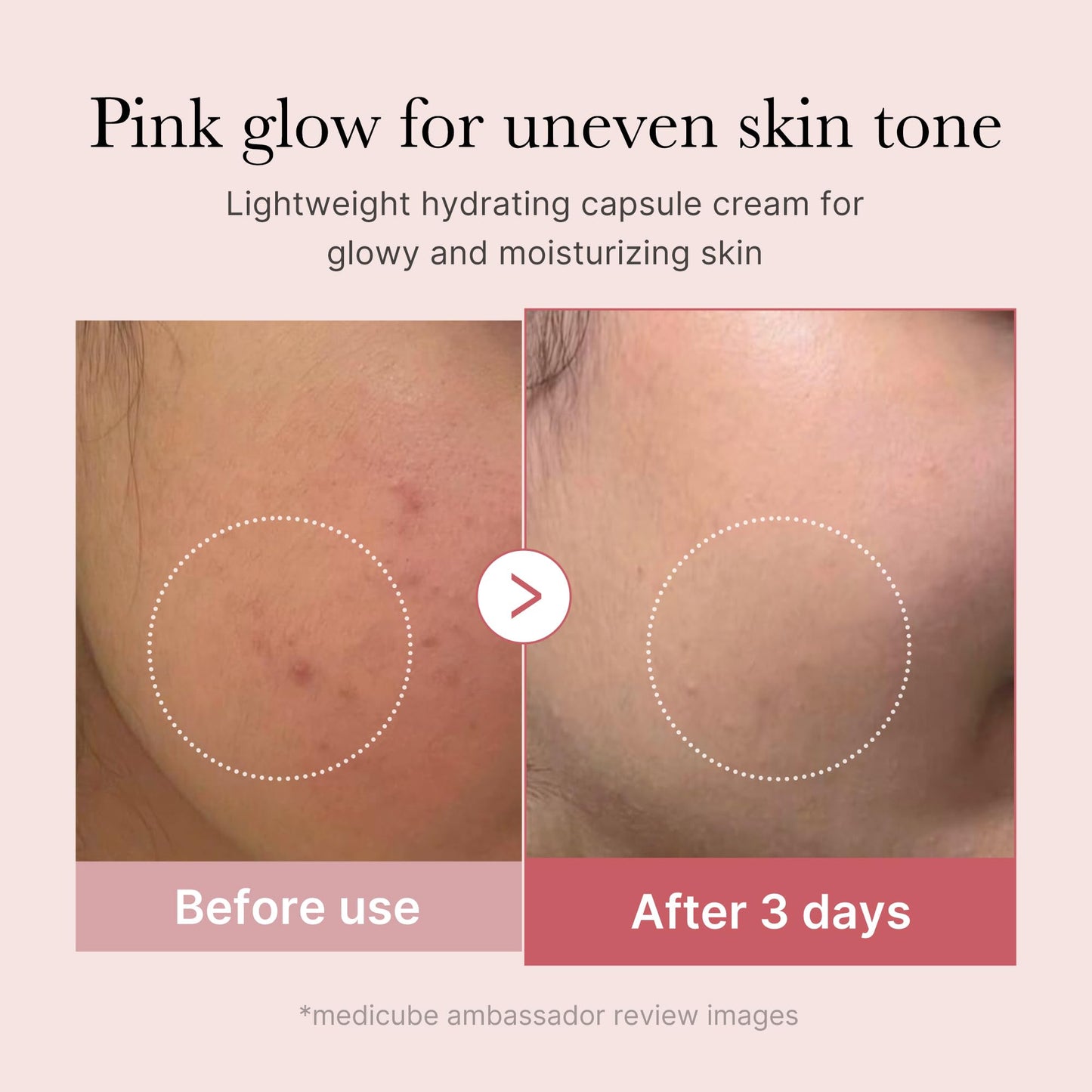 medicube Uneven Skin & Firm Capsule Duo: Deep Vitamin C Golden Capsule Face Moisturizer and Salmon DNA PDRN Pink Collagen Capsule Cream