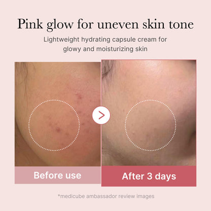 medicube Uneven Skin & Firm Capsule Duo: Deep Vitamin C Golden Capsule Face Moisturizer and Salmon DNA PDRN Pink Collagen Capsule Cream
