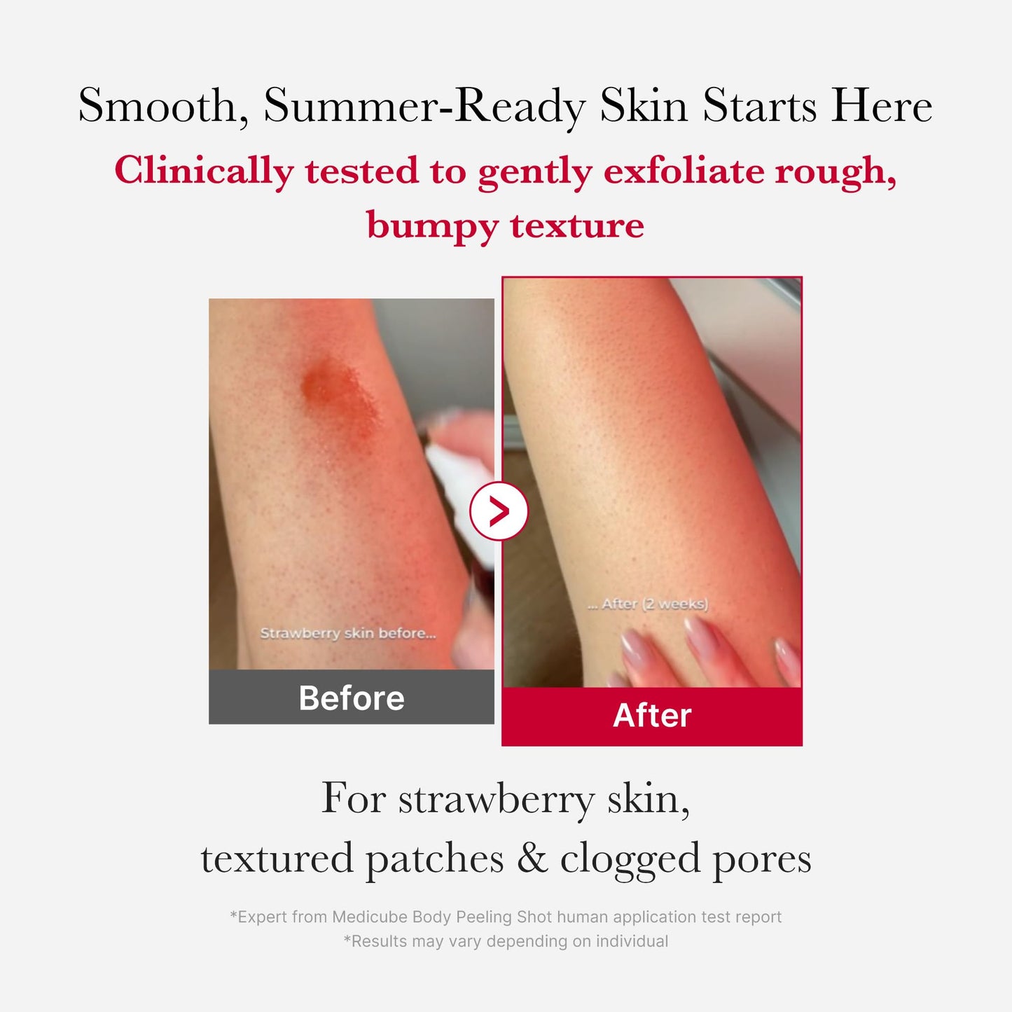 medicube Ultimate Red Spray Duo to Smooth & Soothe: Power Soothing Spray and Red Body Peeling Shot