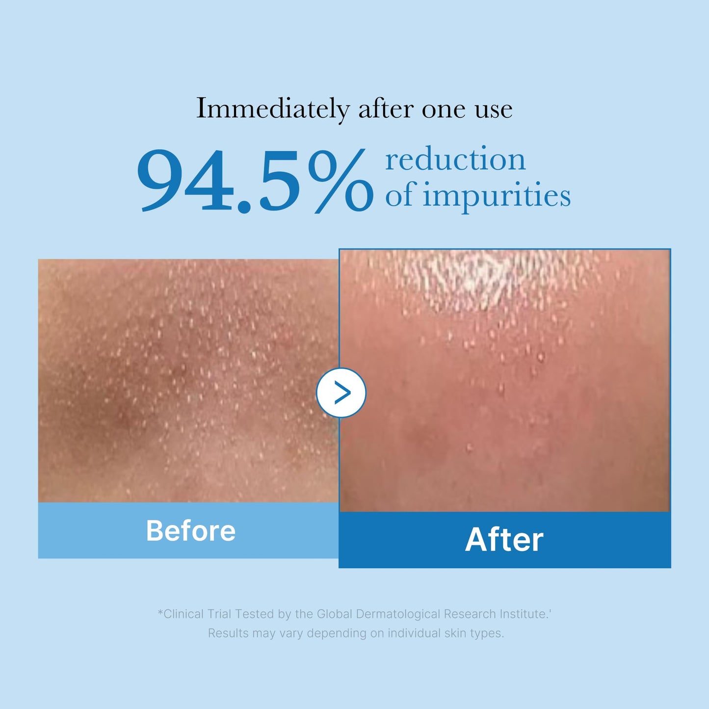 medicube Smooth Pore Double Cleanse Set: Zero Pore Blackhead Deep Cleansing Oil and Zero Pore Clear Blue Capsule Facial Cleanser