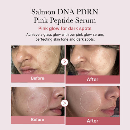 medicube Salmon DNA PDRN Duo for Beginner - Salmon DNA PDRN pink collagen jelly gel mask (4ea) + Salmon DNA PDRN Pink Peptide Serum, Pink glow serum