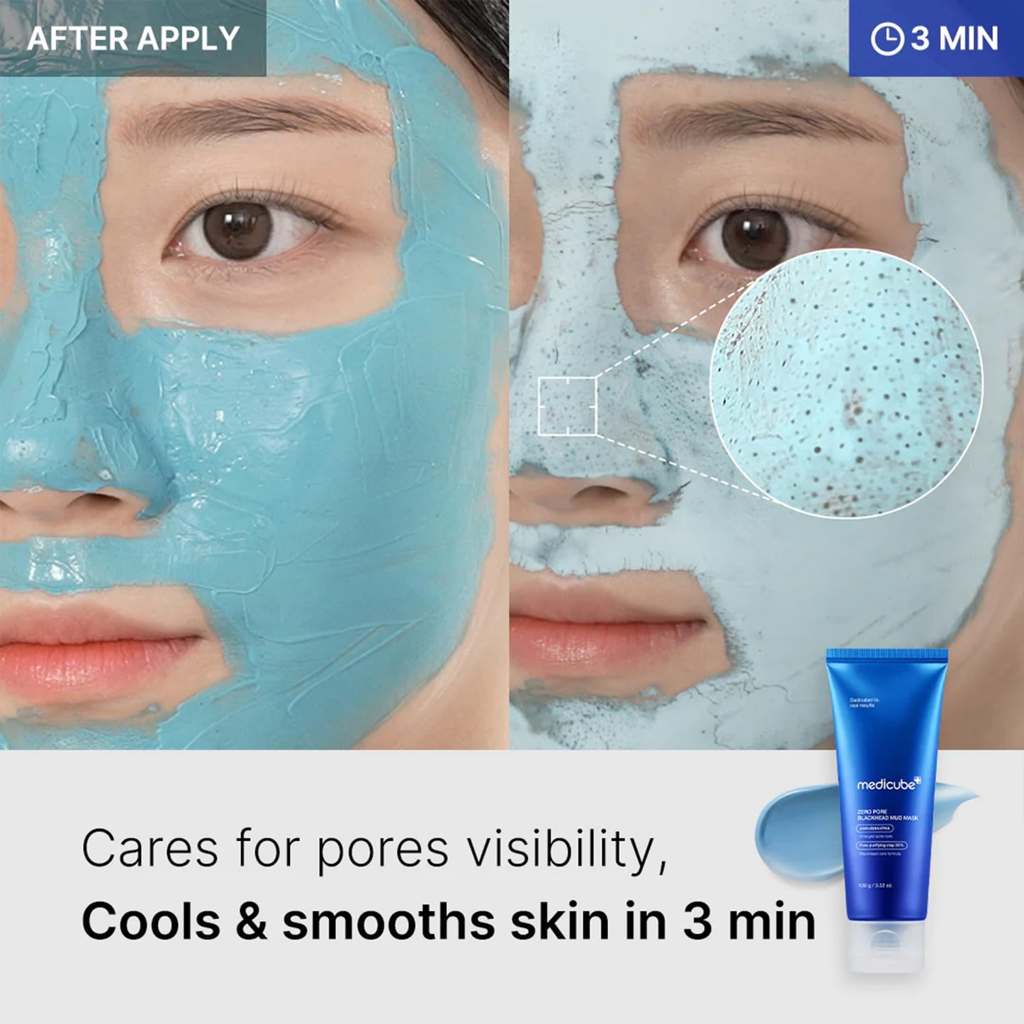 medicube Zero Pore Blackhead Mud Mask with Jelly Brush
