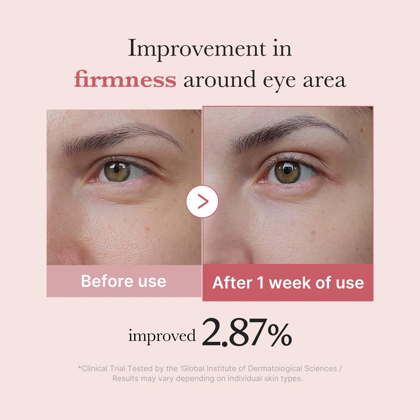 medicube Salmon DNA PDRN Pink Peptide Eye Serum with Niacinamide and 99% Purity Retinol for Fine Lines, Uneven Skin Tone, Korean Skin Care 1.01fl.oz