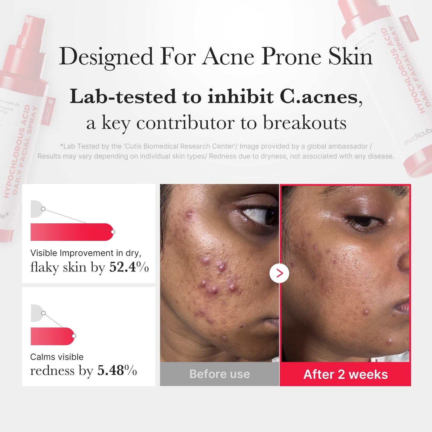 medicube Power Soothing Spray | Hypochlorous Acid Daily Facial Mist for Calming & Soothing | Niacinamide for Uneven Skin Tone & Texture | Korean Skincare | 4.22 fl.oz