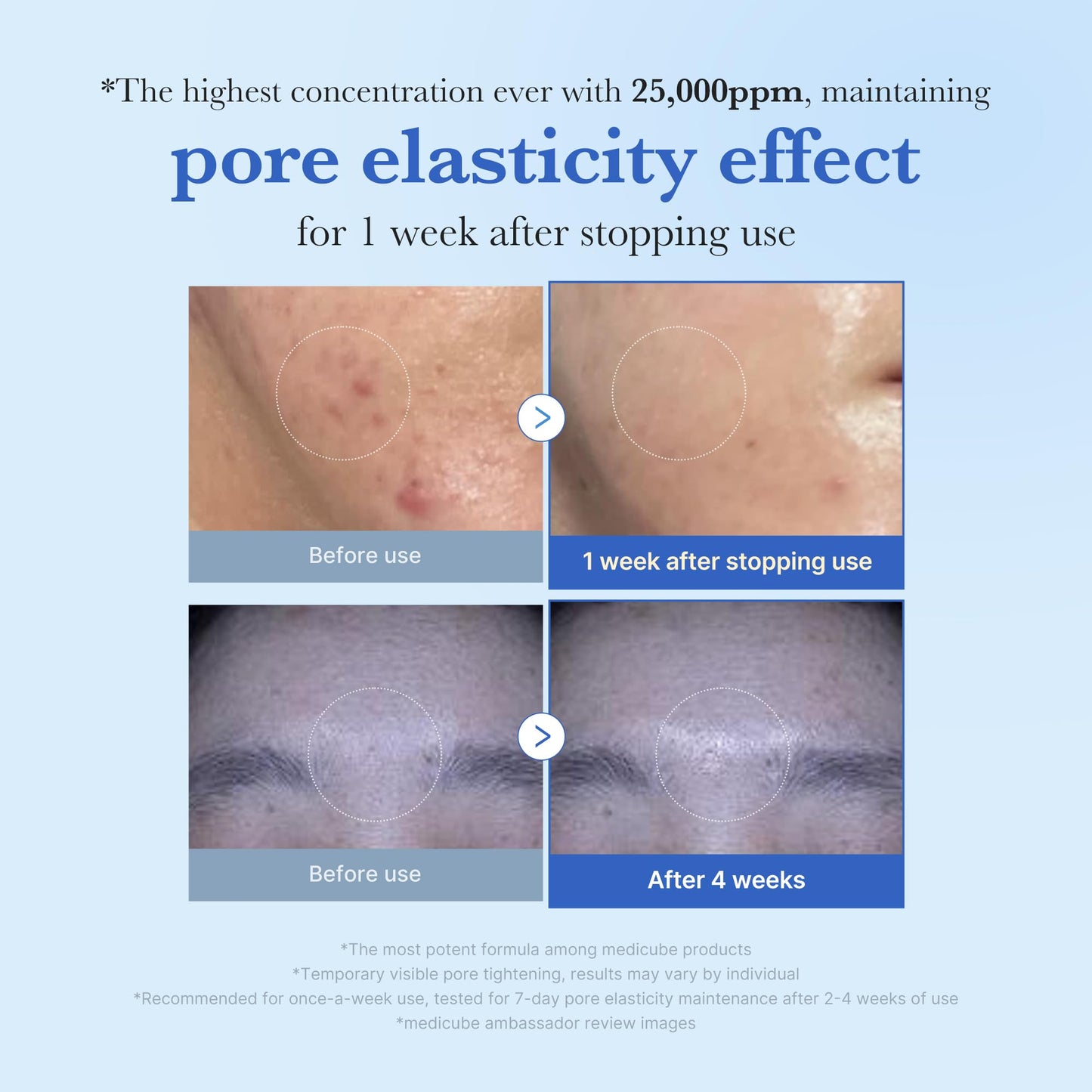 medicube Exosome Shot Master Advanced Pore Care: Zero Exosome Shot 7,500 PPM Spicule Facial Serum and Zero Exosome Shot 25,000 PPM Spicule Facial Serum