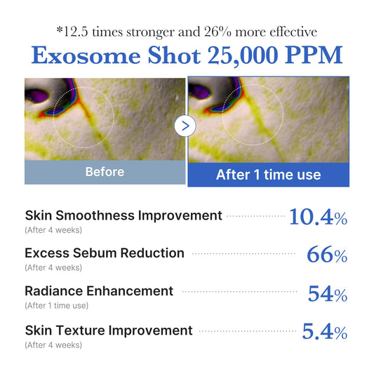 medicube Exosome Shot Master Advanced Pore Care: Zero Exosome Shot 7,500 PPM Spicule Facial Serum and Zero Exosome Shot 25,000 PPM Spicule Facial Serum