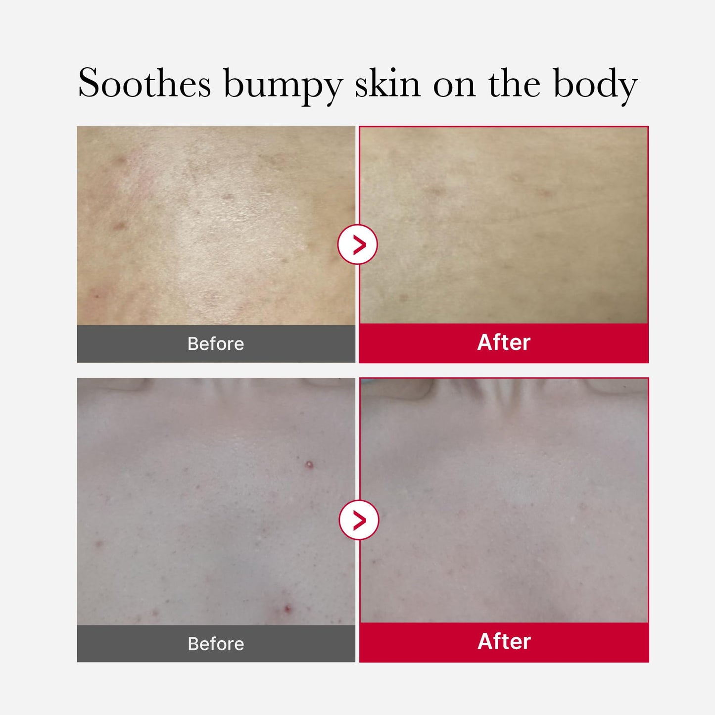 medicube red glow body essentials- Red Body Peeling Shot Body Spray Cleanser + Red Body Wash
