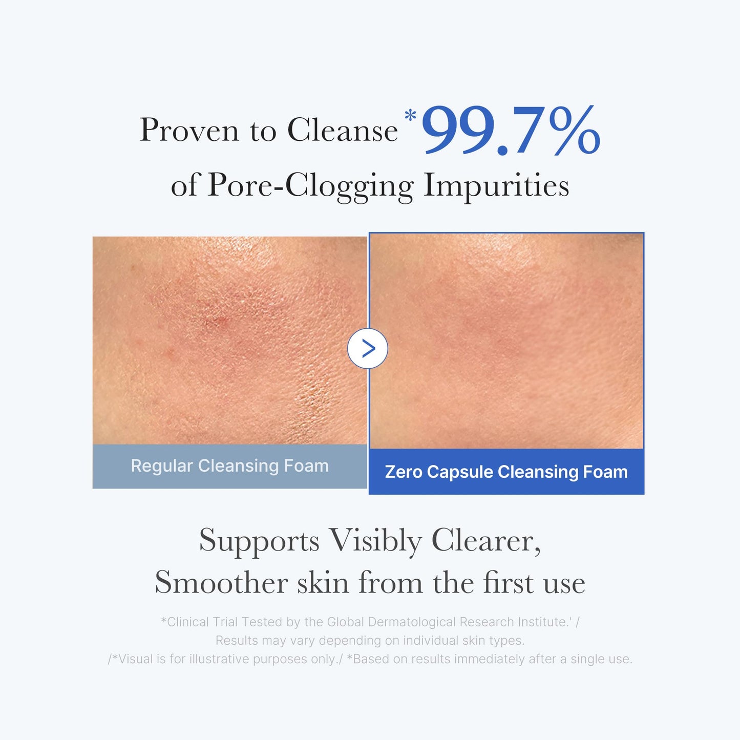 medicube Cleansing Texture Trio: Zero Foam for Sensitive Skin, Blue Capsule Deep Cleanser & PDRN Whip Wash