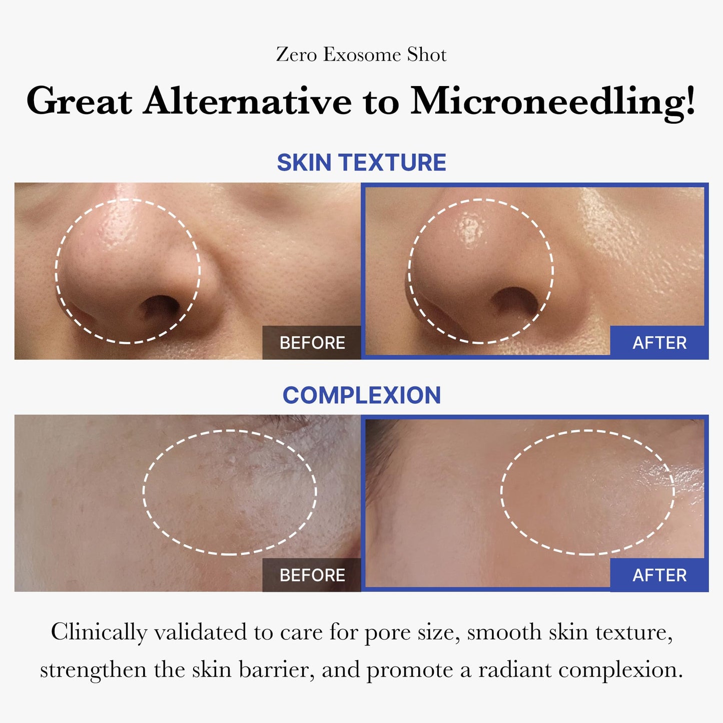 medicube Flawless Skin: Deep Vitamin C Golden Capsule Face Moisturizer and Zero Exosome Shot 7,500 PPM Spicule Facial Serum