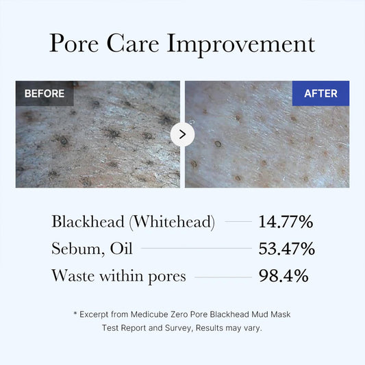 medicube Korean Home-Spa Pore Care Routine: Zero Pore Blackhead Deep Cleansing Oil and Zero Pore Blackhead Mud Facial Mask