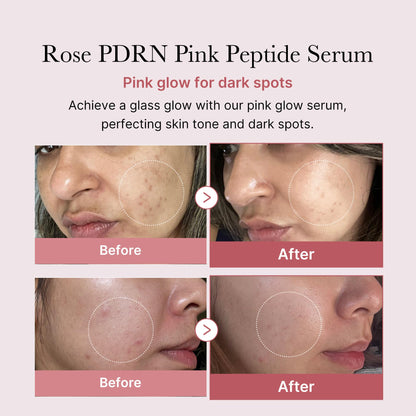 medicube Affordable Pink Routine Duo: Age-R Booster Pro Pink | 6-in-1 Real Glass Glow Beauty Massager and PDRN Peptide Serum