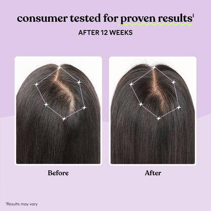 Lemme Grow Hair Growth Supplement for Women, Clinically Proven Keratin Complex for Visibly Thicker Hair and Scalp Coverage, Reduced Shedding, Nourish Thinning Hair - 1 Month Supply
